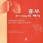 군자출판사  흉부 X-RAY의 해석
