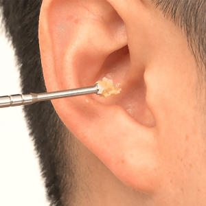 아케이 리빙 귀지킬러 6종 세트 389685