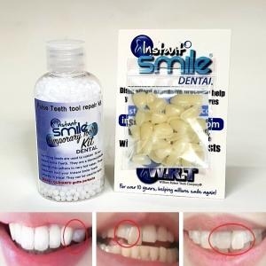 임시치아 인공치아 수리키트 50ml